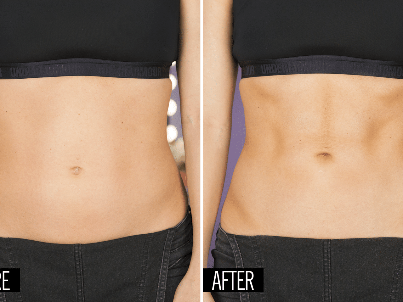 SlimVi Before and After Result